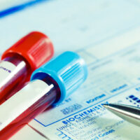 Blood Alcohol Test Blood Alcohol Test